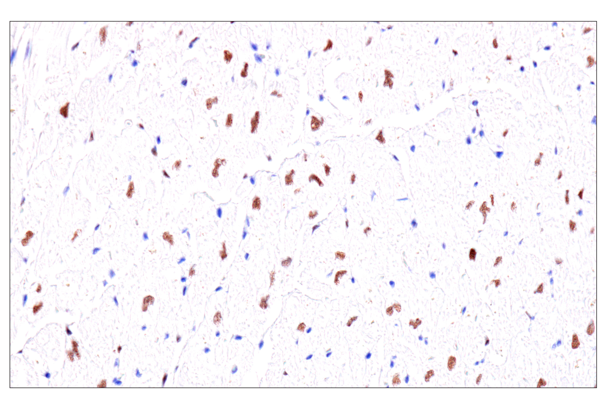  Image 39: Cardiogenesis Marker Antibody Sampler Kit
