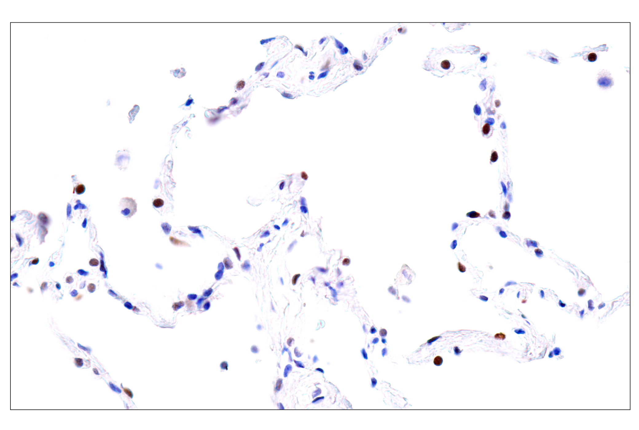  Image 37: Cardiogenesis Marker Antibody Sampler Kit