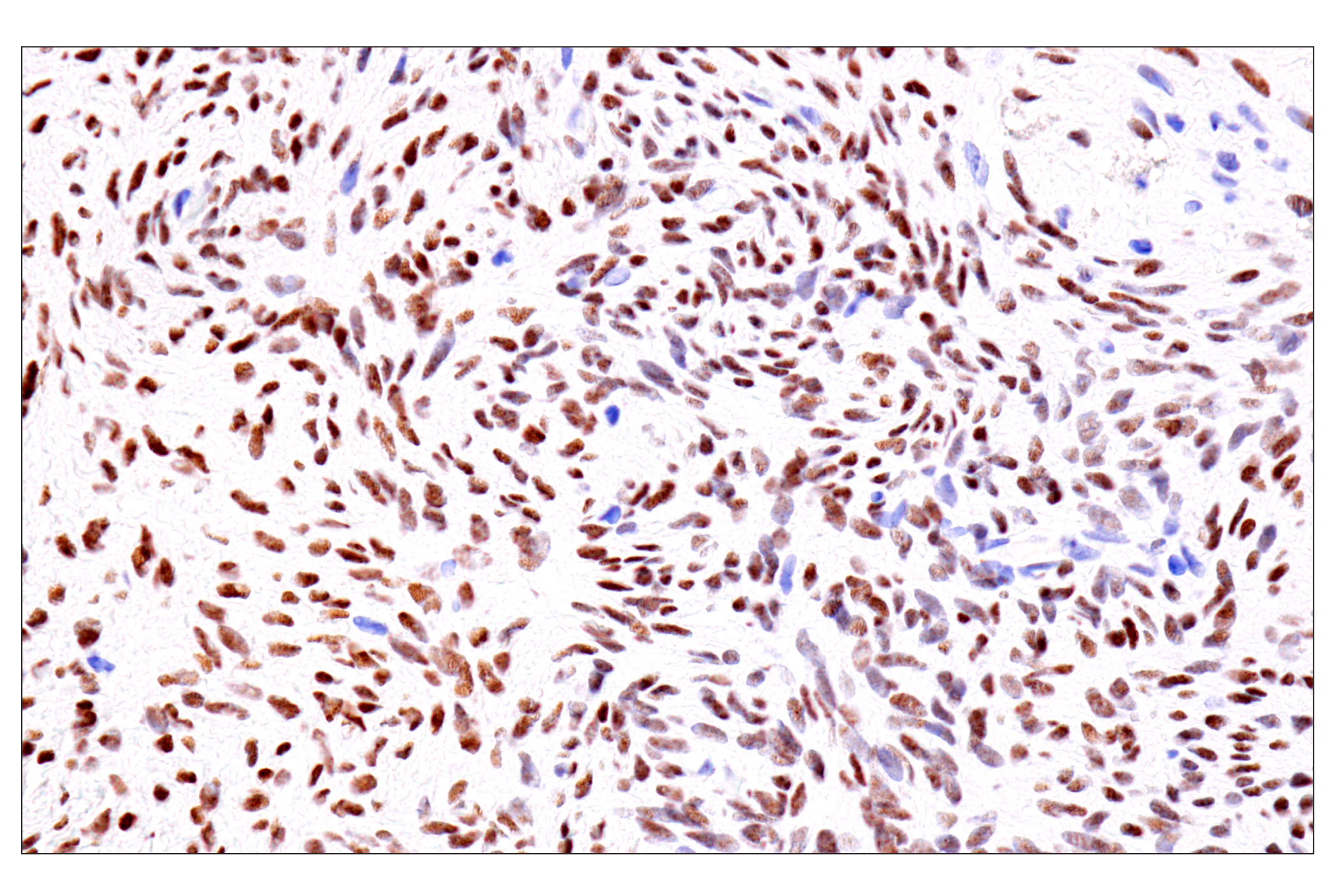 Image 36: Cardiogenesis Marker Antibody Sampler Kit