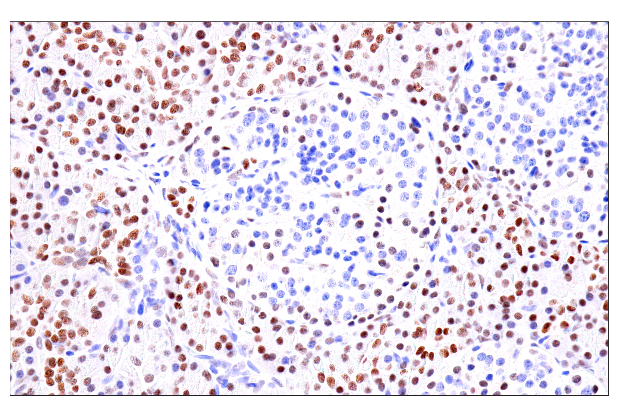  Image 35: Cardiogenesis Marker Antibody Sampler Kit