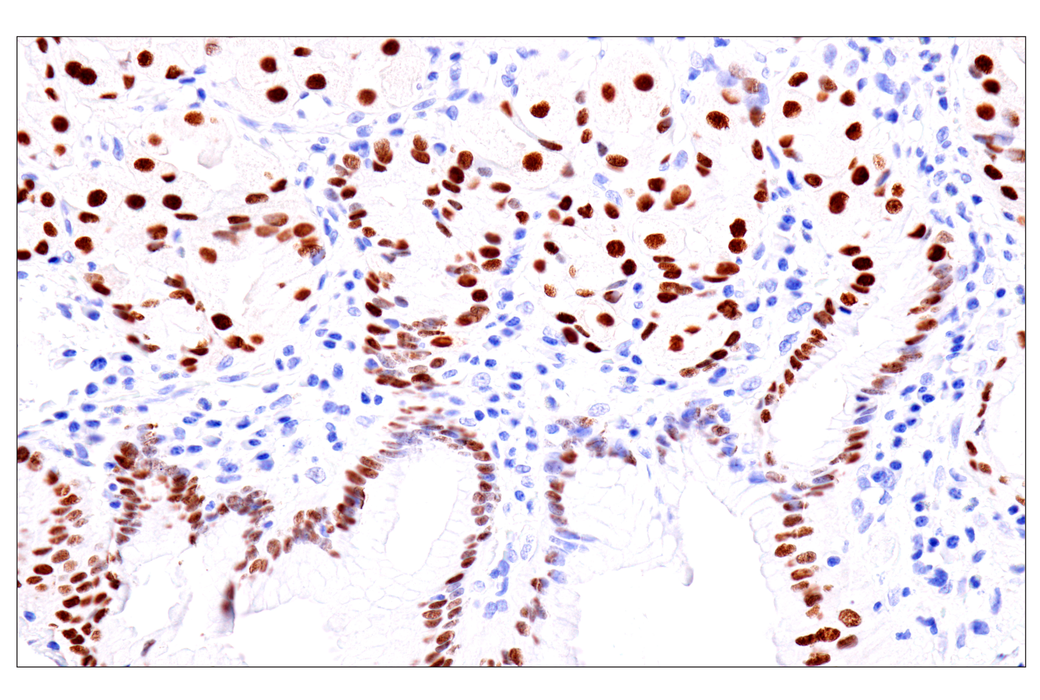  Image 32: Cardiogenesis Marker Antibody Sampler Kit