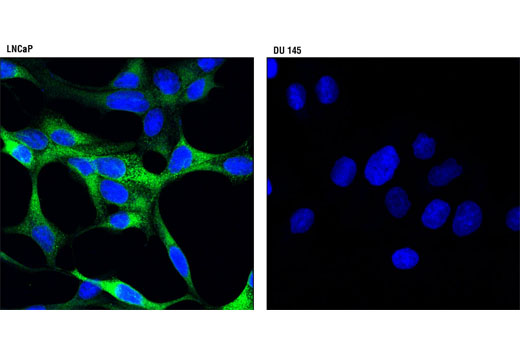 Immunofluorescence Image 1: PSA/KLK3 (D2A8) Rabbit mAb