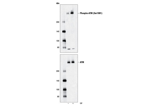  Image 8: Double Strand Breaks (DSB) Repair Antibody Sampler Kit