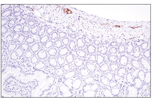  Image 25: Functional Neuron Marker Antibody Sampler Kit