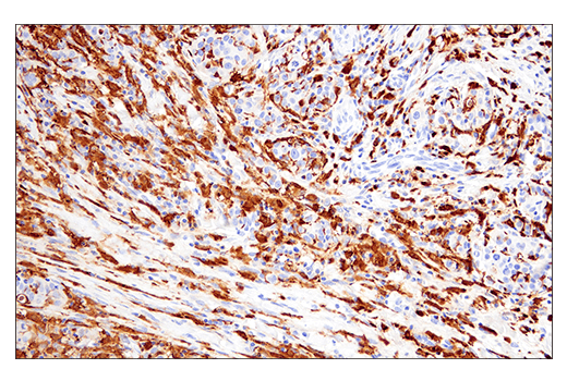 Immunohistochemistry Image 6: Iba1/AIF-1 (E5N4J) Mouse mAb (IHC Formulated)