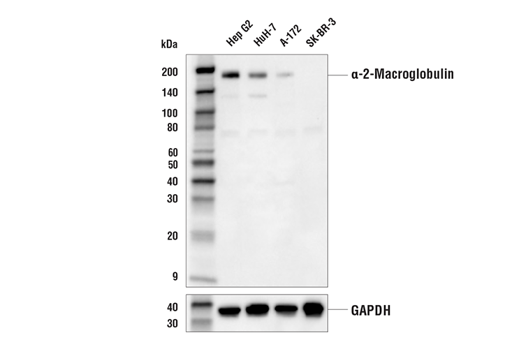 Western Blotting Image 1: α-2-Macroglobulin Antibody