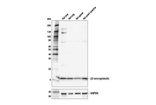 Western Blotting Image 1: β2-microglobulin Antibody