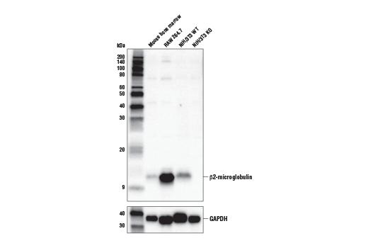 Western Blotting Image 2: β2-microglobulin Antibody