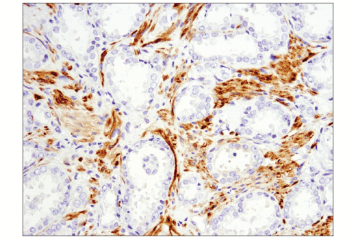 Immunohistochemistry Image 4: OX40L (D6K7R) Rabbit mAb