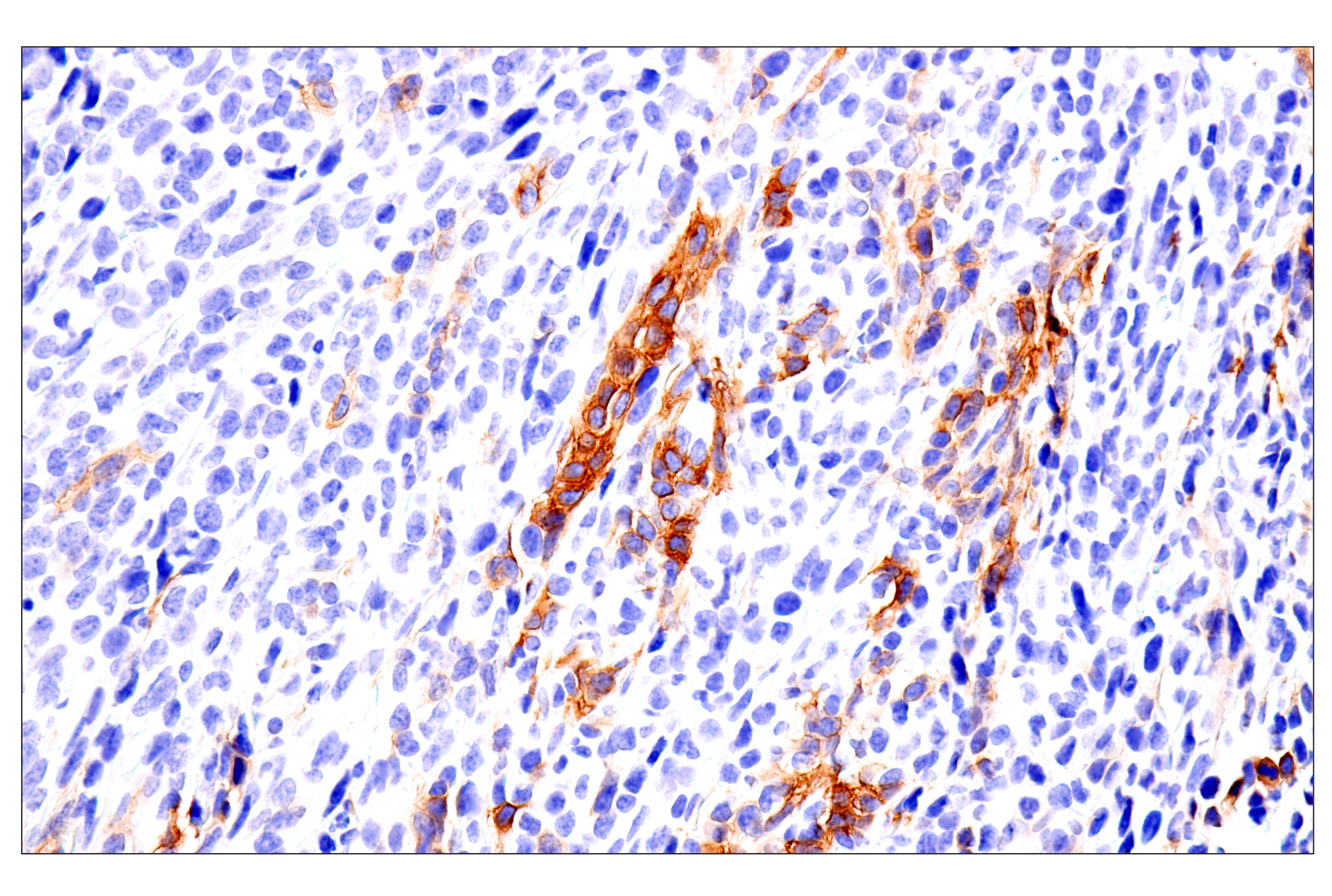 Immunohistochemistry Image 14: p75NTR (E7I3M) Rabbit mAb (BSA and Azide Free)