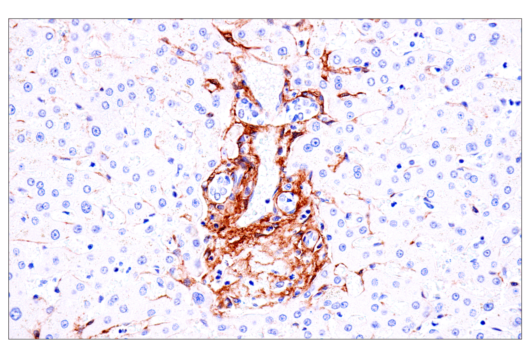 Immunohistochemistry Image 12: p75NTR (E7I3M) Rabbit mAb (BSA and Azide Free)