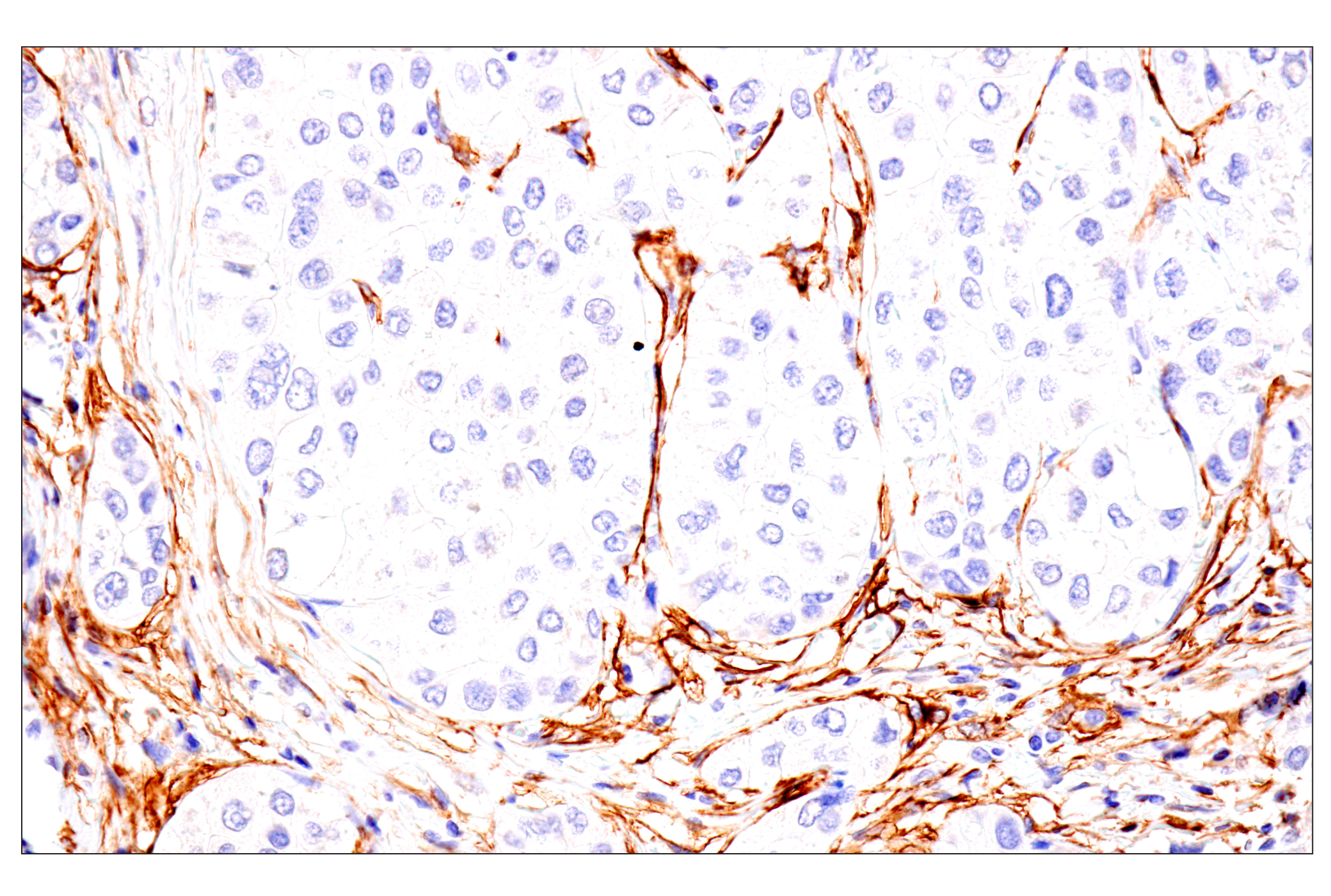 Immunohistochemistry Image 3: p75NTR (E7I3M) Rabbit mAb (BSA and Azide Free)