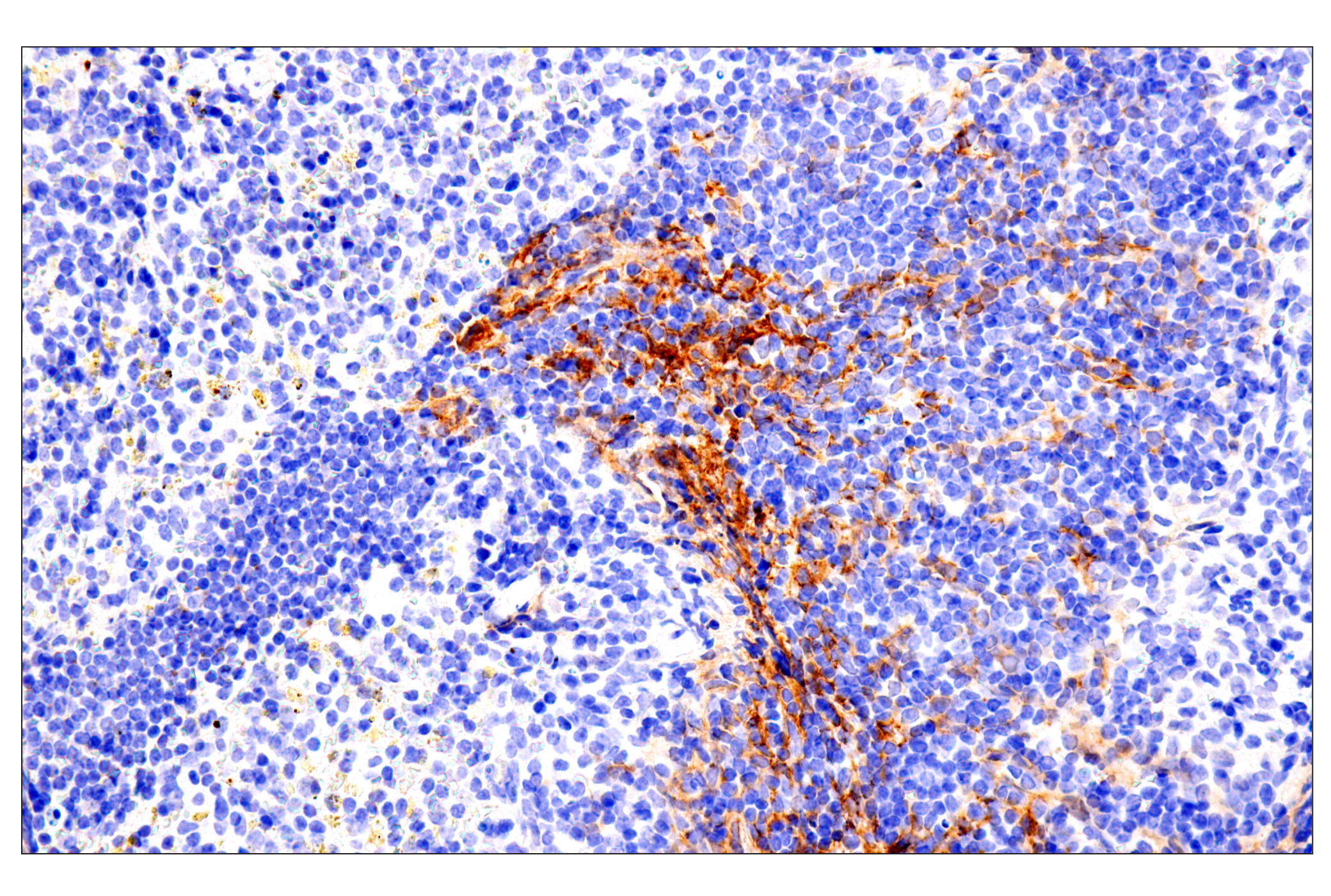 Immunohistochemistry Image 16: p75NTR (E7I3M) Rabbit mAb (BSA and Azide Free)