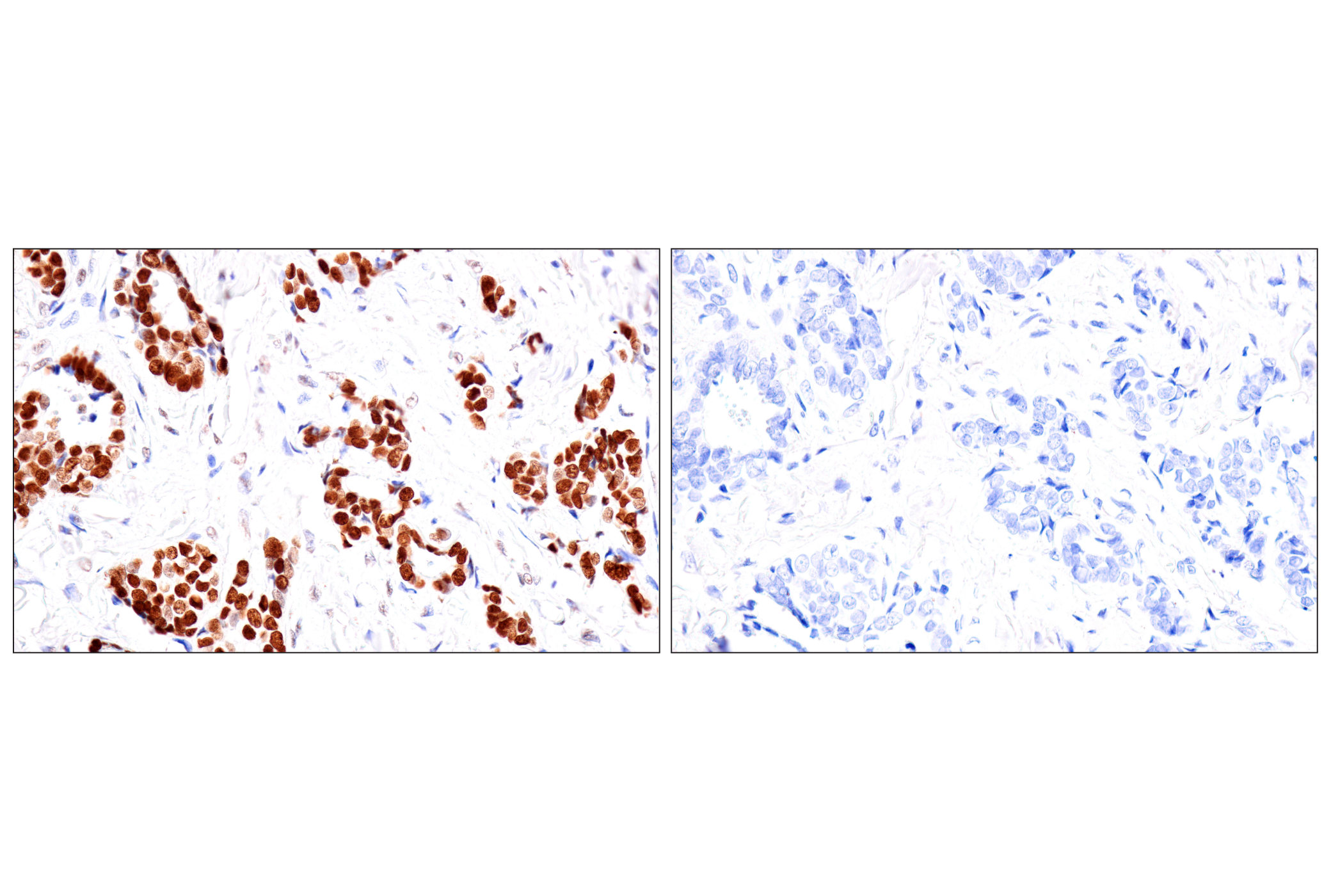 Immunohistochemistry Image 18: FoxA1/HNF3α (IHC578) Mouse mAb