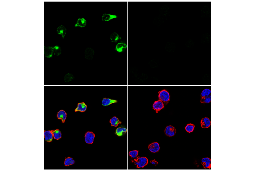 Immunofluorescence Image 1: GNLY (E1V5M) Rabbit mAb (BSA and Azide Free)