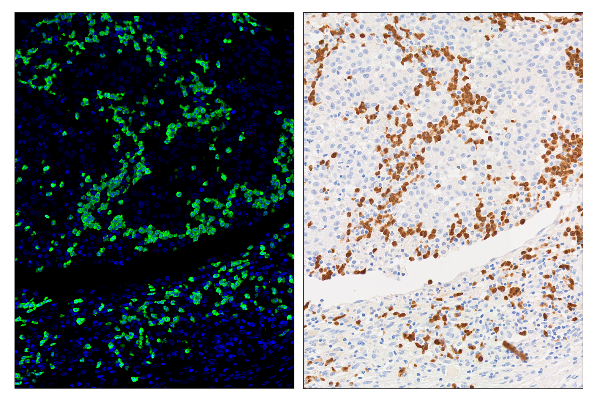 Immunohistochemistry Image 5: Arginase-1 (D4E3M) & CO-0075-488 SignalStar™ Oligo-Antibody Pair