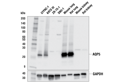 Western Blotting Image 1: AQP5 Antibody