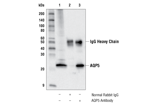Immunoprecipitation Image 1: AQP5 Antibody