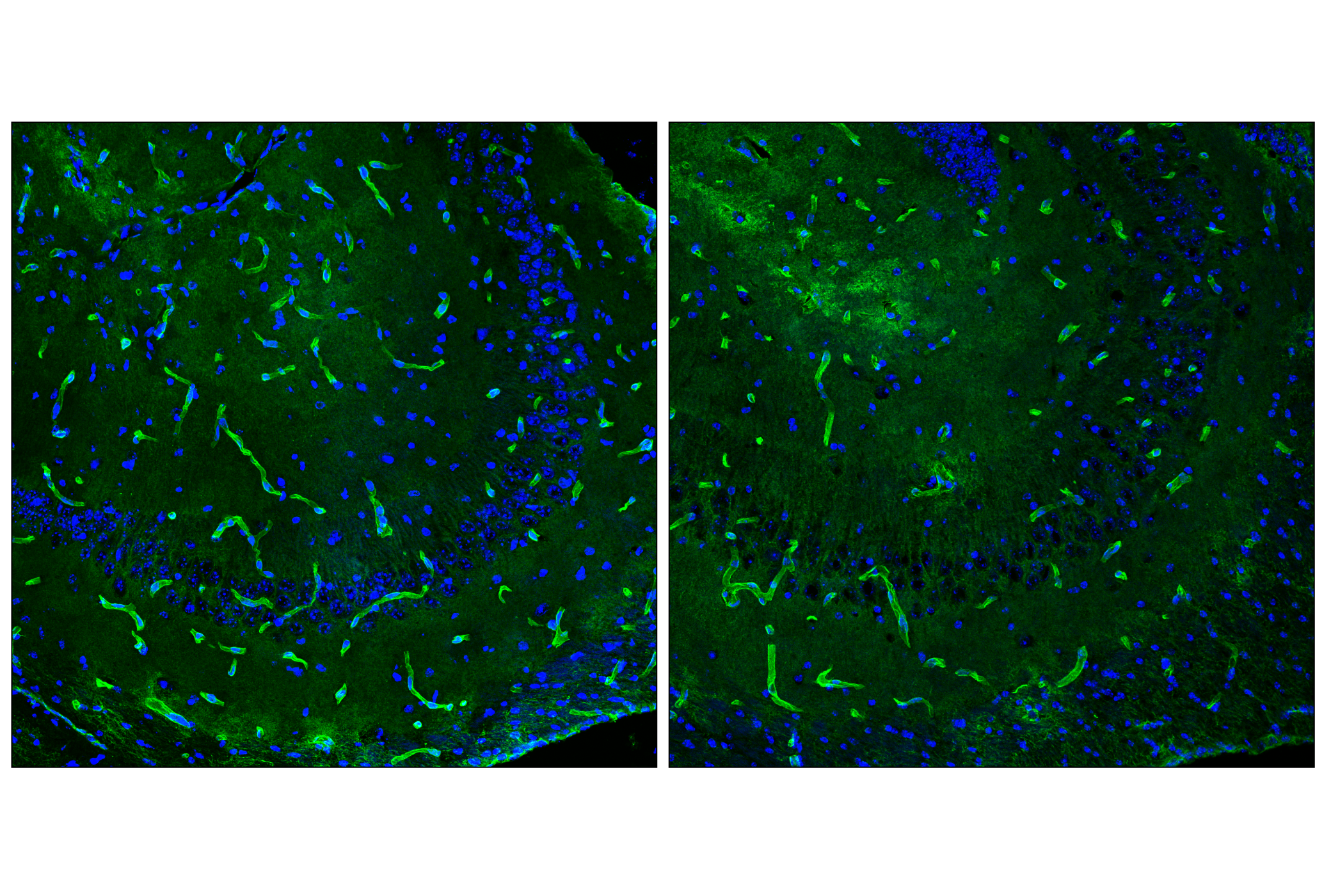 Immunofluorescence Image 4: AQP4 (D1F8E) XP<sup>®</sup> Rabbit mAb