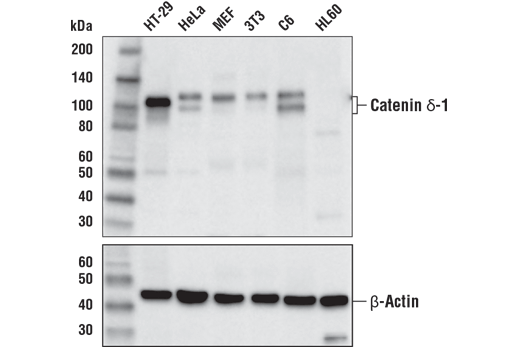 Western Blotting Image 1: Catenin δ-1 (D7S2M) XP® Rabbit mAb