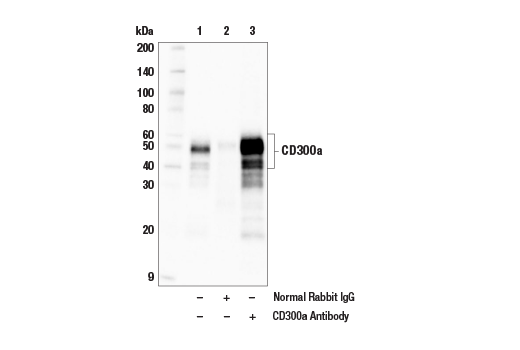 Immunoprecipitation Image 1: CD300a Antibody