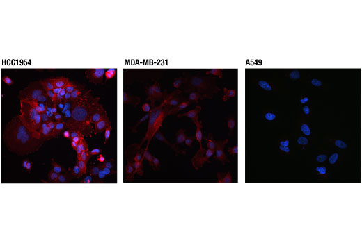 Immunofluorescence Image 1: PD-L1 (Extracellular Domain Specific) (D8T4X) Rabbit mAb (Alexa Fluor® 594 Conjugate)