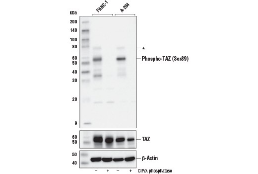  Image 1: PhosphoPlus® TAZ (Ser89) Antibody Duet