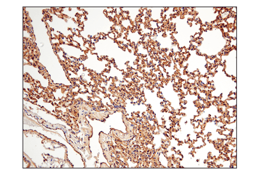  Image 12: PhosphoPlus® TAZ (Ser89) Antibody Duet