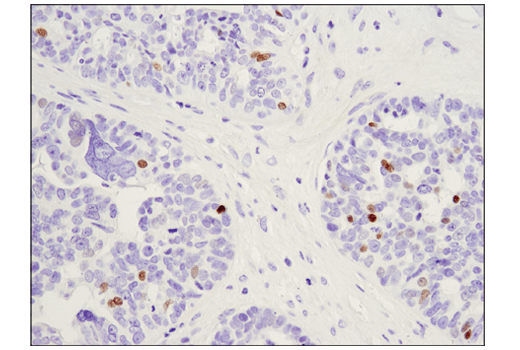Immunohistochemistry Image 2: c-Myb (D1B9E) Rabbit mAb