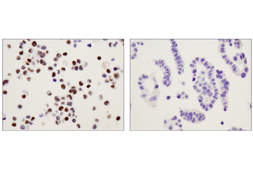 Immunohistochemistry Image 3: c-Myb (D1B9E) Rabbit mAb