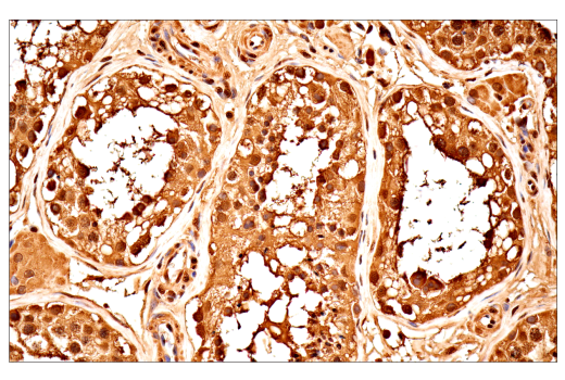 Immunohistochemistry Image 8: Ubiquitin (E6K4Y) XP® Rabbit mAb (BSA and Azide Free)