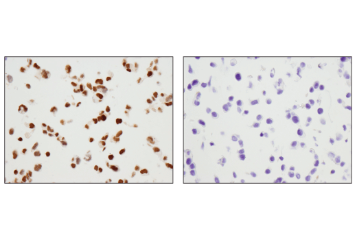  Image 15: Pancreatic Marker IHC Antibody Sampler Kit