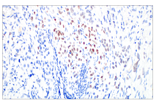 Immunohistochemistry Image 2: Phospho-Histone H2A.X (Ser139) (20E3) Rabbit mAb (BSA and Azide Free)