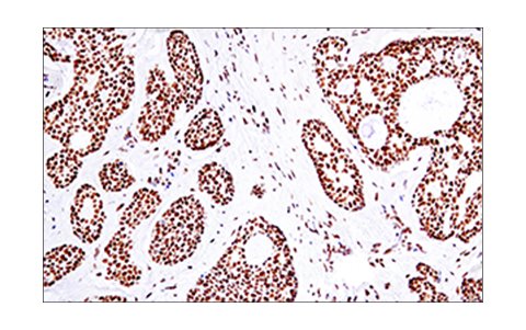 Immunohistochemistry Image 7: 53BP1 (E7N5D) XP® Rabbit mAb (BSA and Azide Free)