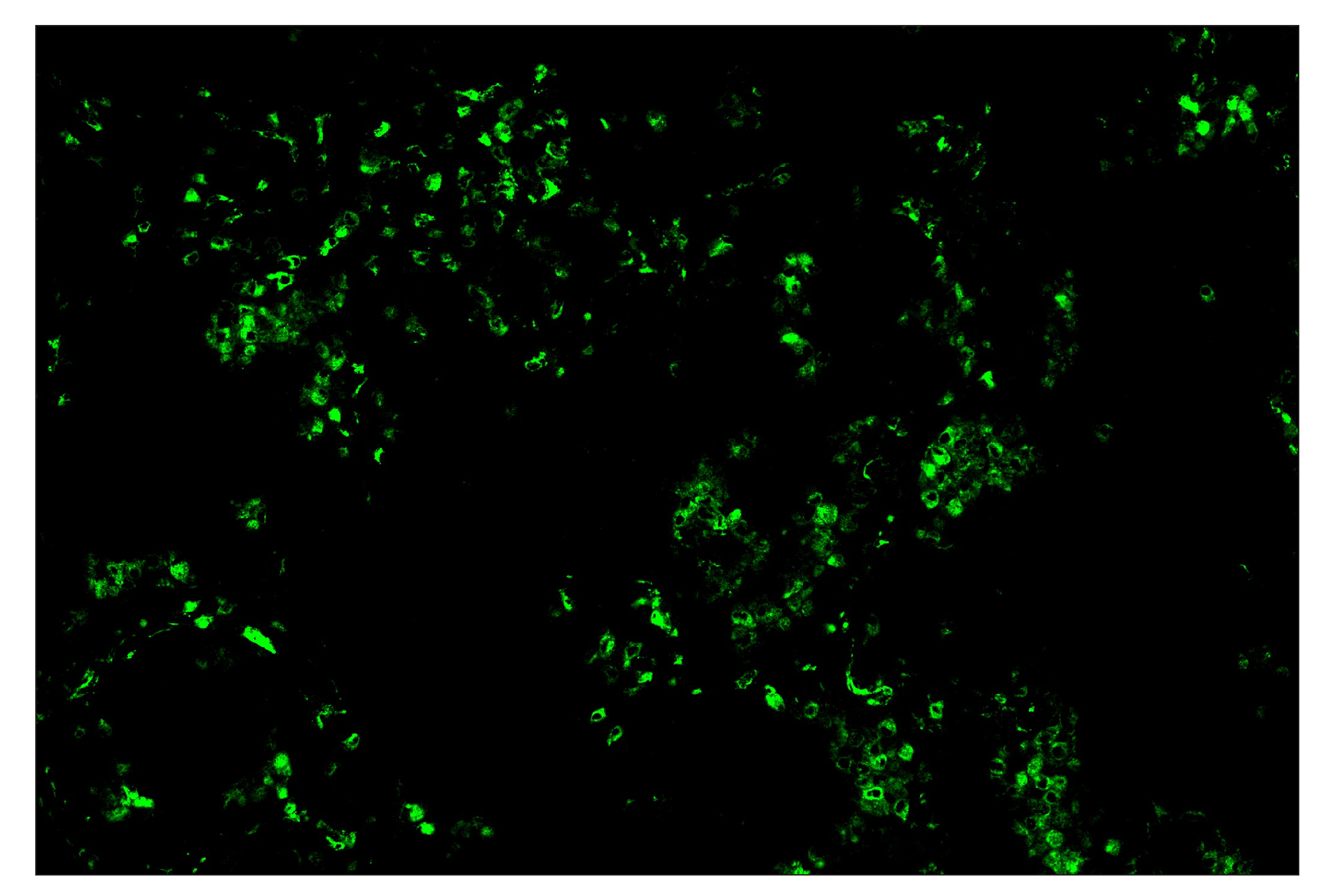 Immunohistochemistry Image 2: CD68 (D4B9C) & CO-0007-488 SignalStar™ Oligo-Antibody Pair