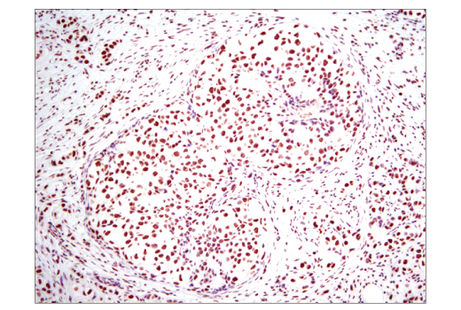 Immunohistochemistry Image 1: Histone H3 (D1H2) XP® Rabbit mAb (BSA and Azide Free)