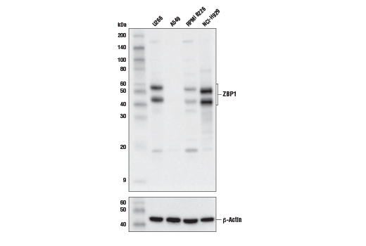 Western Blotting Image 2: ZBP1 Antibody