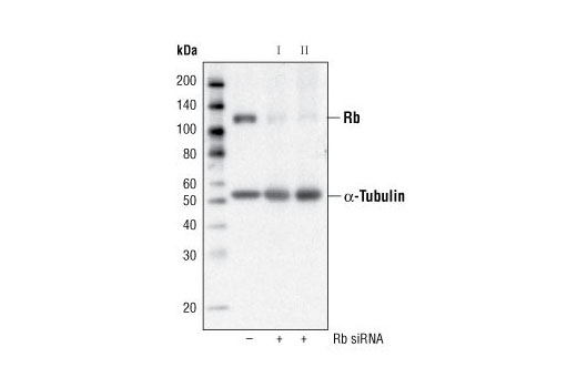 Western Blotting Image 1: Rb (4H1) Mouse mAb (BSA and Azide Free)