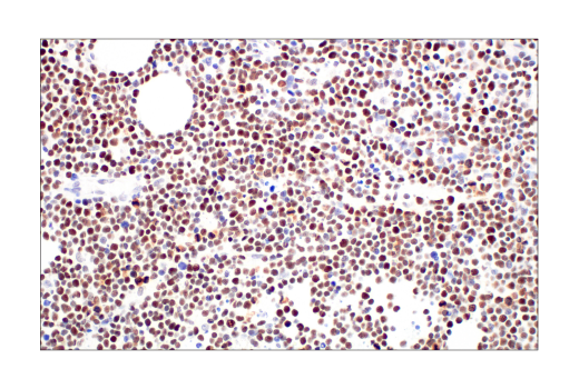 Immunohistochemistry Image 4: Rb (4H1) Mouse mAb (BSA and Azide Free)