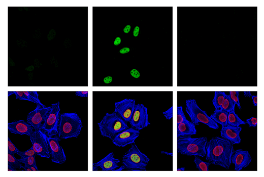 Immunofluorescence Image 1: Phospho-ATF-2 (Thr69/71)/ATF-7 (Thr51/53) (E6A8A) Rabbit mAb