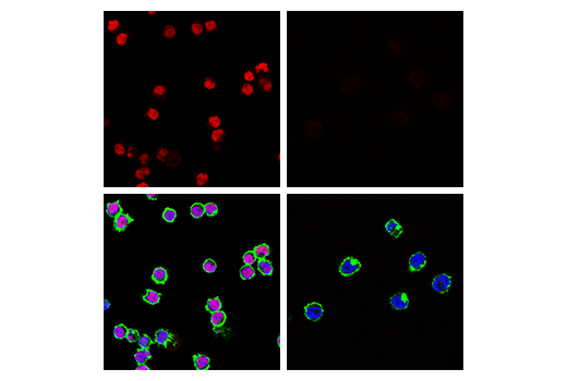 Immunofluorescence Image 4: Tox/Tox2 (E6G5O) Rabbit mAb (Alexa Fluor® 594 Conjugate)