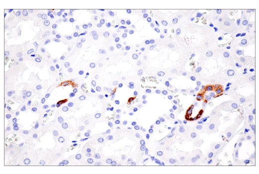 Immunohistochemistry Image 6: CPS1/Hep Par-1 (E9I9U) Rabbit mAb