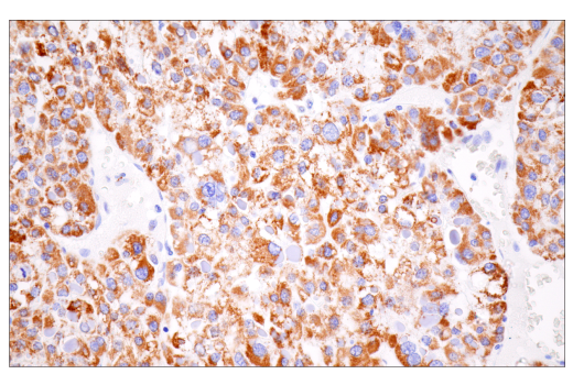 Immunohistochemistry Image 2: CPS1/Hep Par-1 (E9I9U) Rabbit mAb