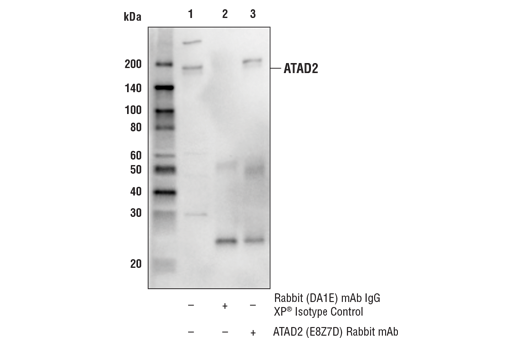 Immunoprecipitation Image 1: ATAD2 (E8Z7D) Rabbit mAb