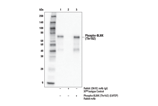 Immunoprecipitation Image 1: Phospho-BLNK (Thr152) (E4P2P) Rabbit mAb
