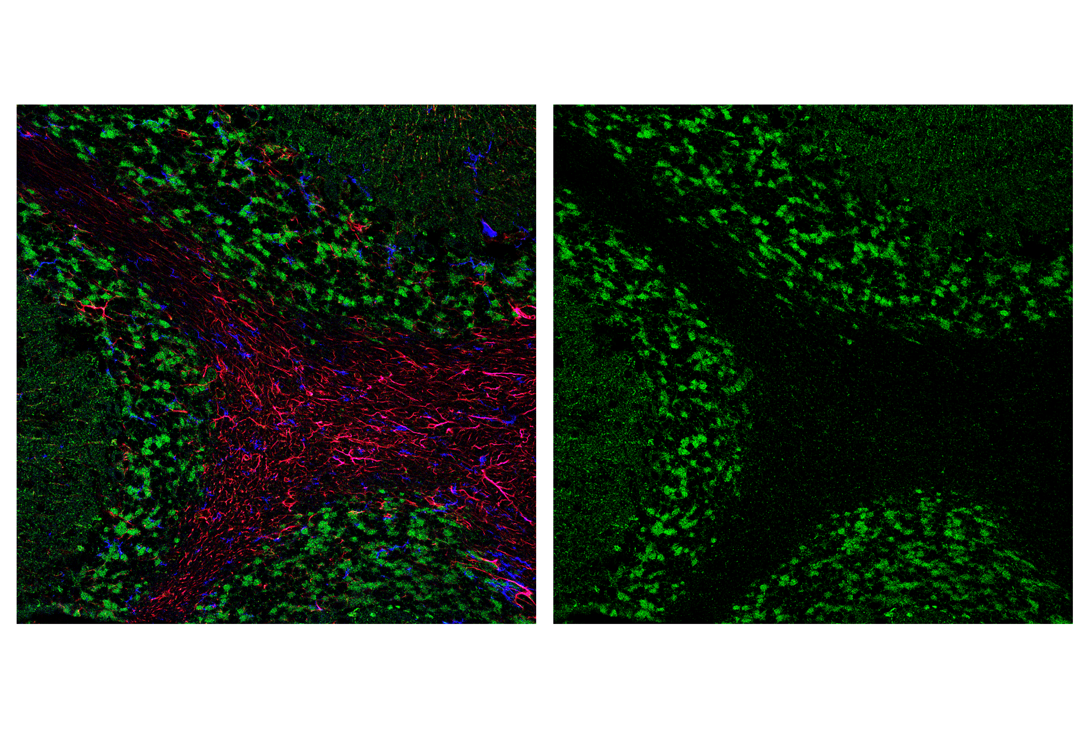 Immunofluorescence Image 3: AIF (D39D2) XP® Rabbit mAb (BSA and Azide Free)