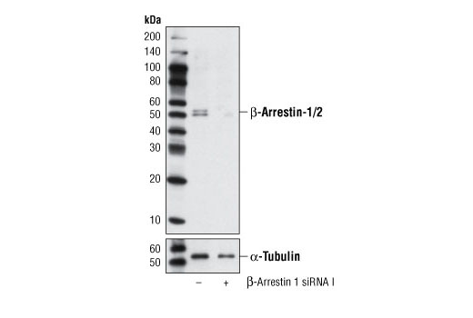  Image 2: SignalSilence® β-Arrestin 1 siRNA I