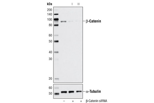  Image 1: SignalSilence® β-Catenin siRNA I