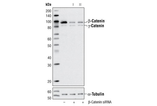  Image 2: SignalSilence® β-Catenin siRNA I