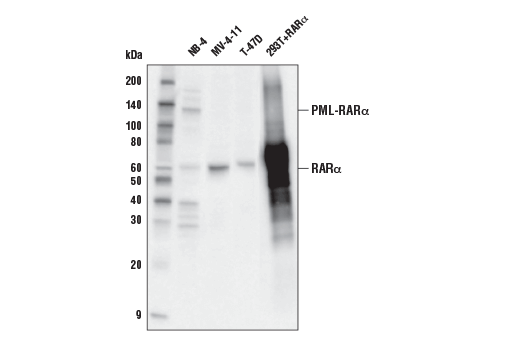  Image 3: Retinoic Acid and Retinoid X Receptors Antibody Sampler Kit